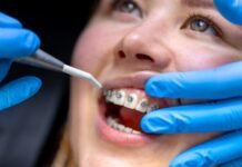 The Role of the Orthodontist After Dental Trauma